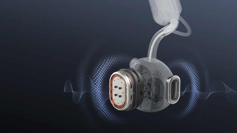 Vizualizácia technológie DualPitch_03