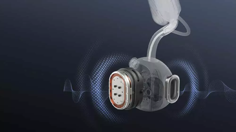 Vizualizace technologie DualPitch_03