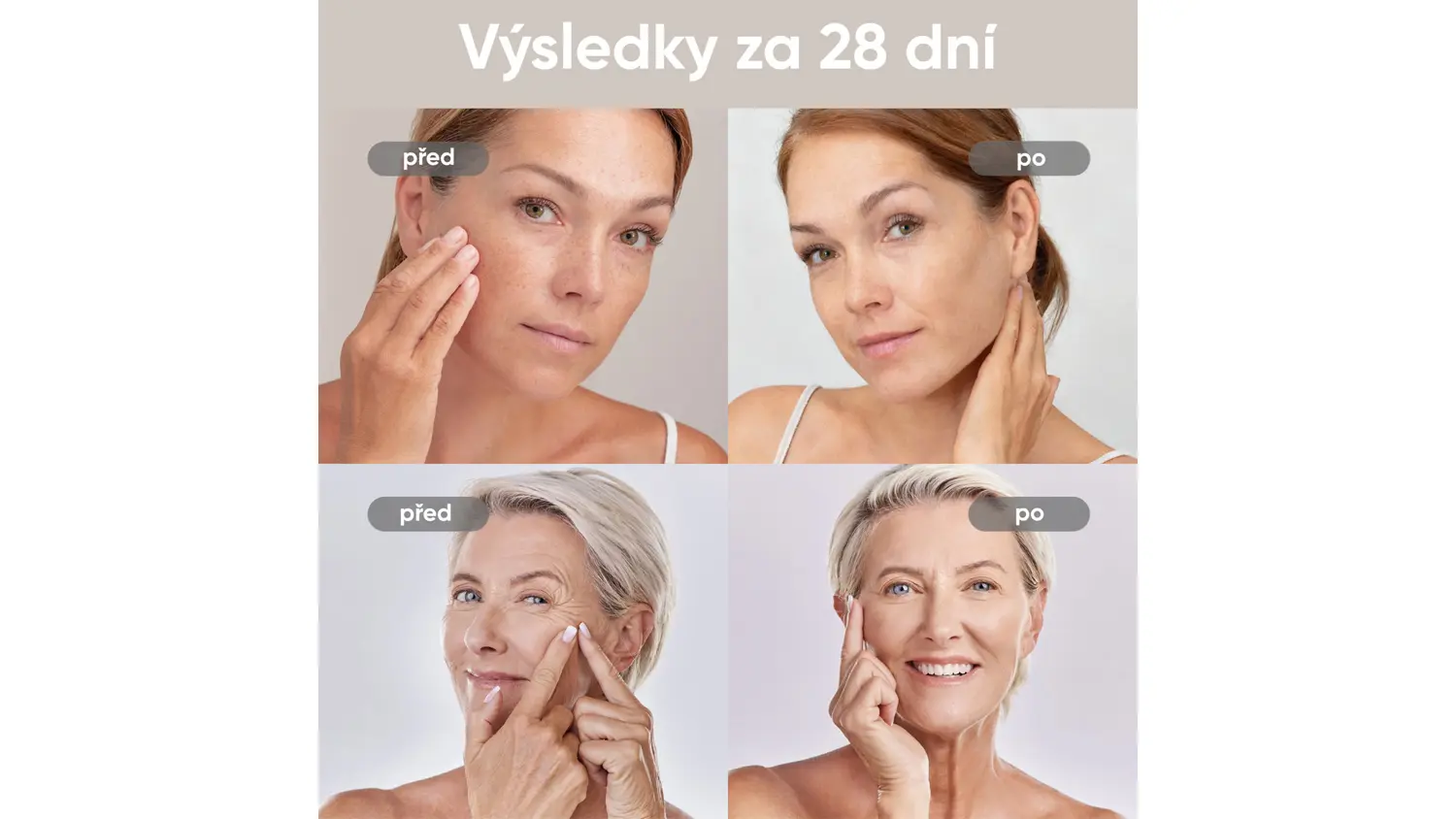 Porovnání pleti před a po použití laserové světelné terapeutické masky JOVS 4D v2