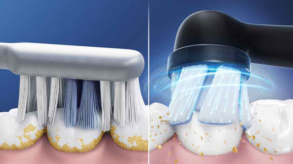 Zubní kartáček ORAL B iO 2, porovnání s běžným kartáčkem_02