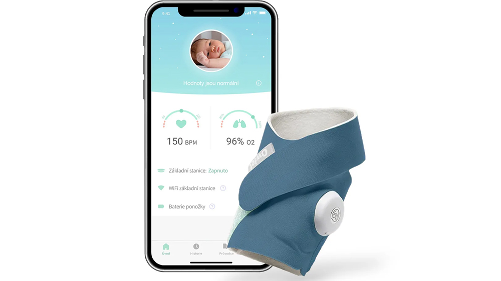 Chytrá dětská ponožka Owlet Smart Sock 3_01