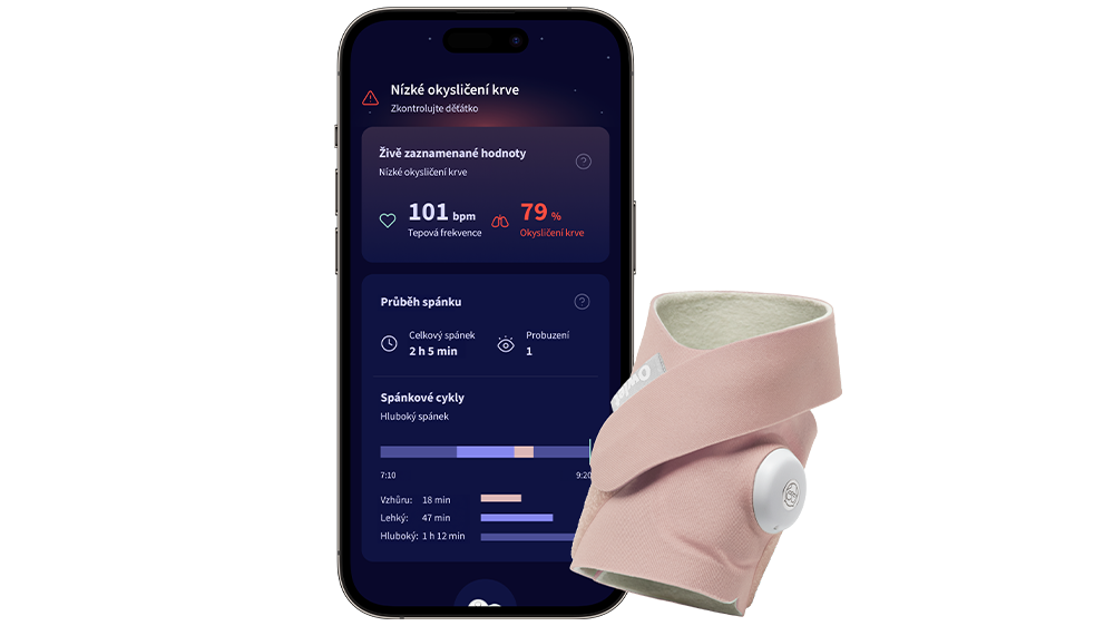 Mobiln&iacute; aplikace Owlet care vyobrazen&aacute; v mobiln&iacute;m telefonu s chytrou ponožkou