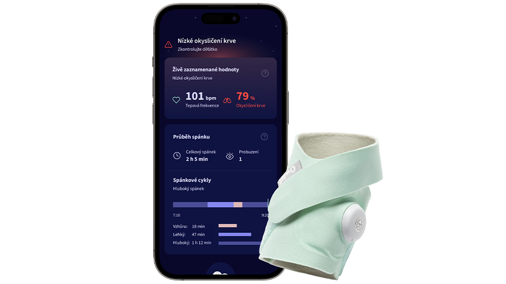 Mobilní aplikace Owlet care vyobrazená v mobilním telefonu s chytrou ponožkou