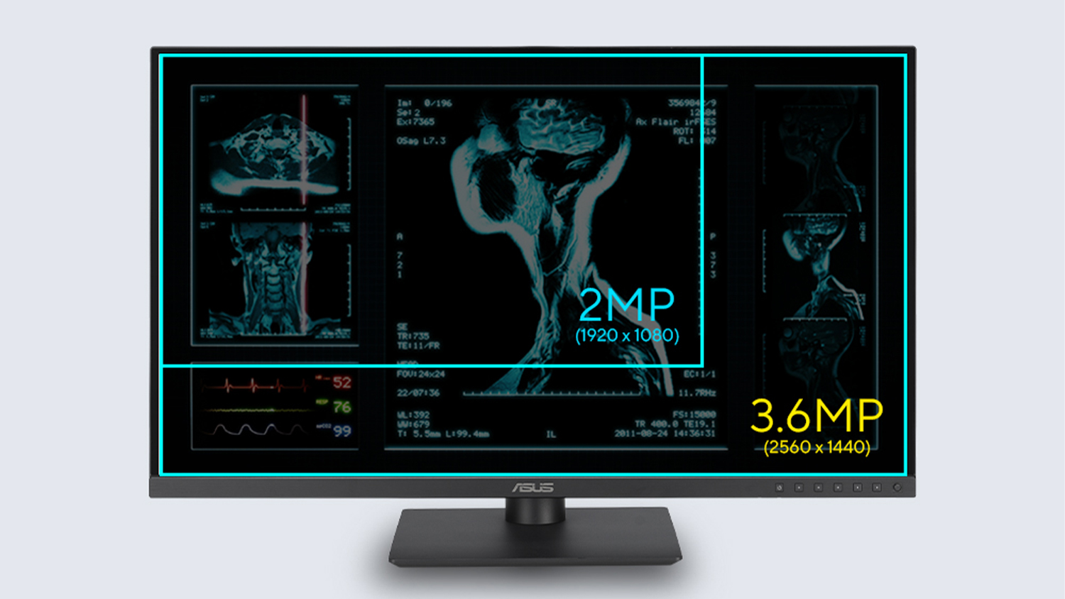 porovnanie r&ocirc;znych rozl&iacute;&scaron;en&iacute; monitora ASUS HA2741A