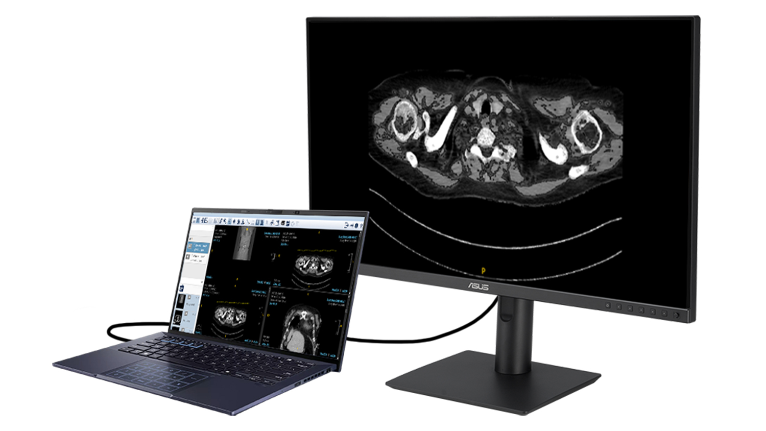 Monitor ASUS HA2741A pripojen&yacute; k notebooku